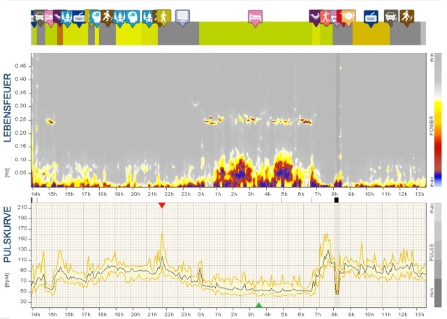 Schnarchen Schnarchen